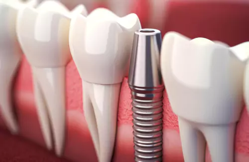متى تحتاج إلى زيارة طبيب الأسنان؟